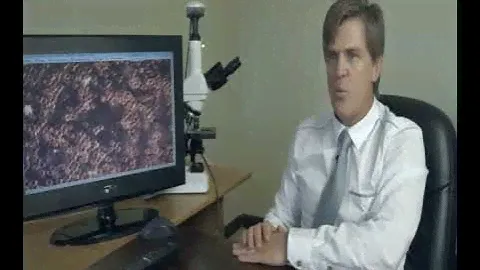 Aqua Ozone Elite Doctor Explainer